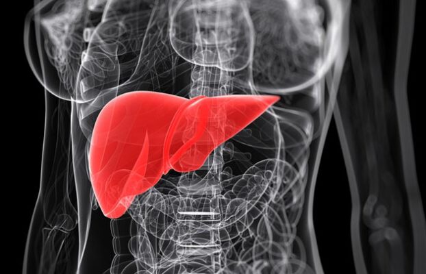 Hepatit A