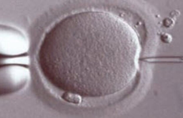 ICSI-Mikroenjeksiyon (Intra Cytoplasmic Sperm Injection)